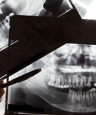 치아 전반 진단 및 충치 발치 치료가 가능한 2D 진단장비