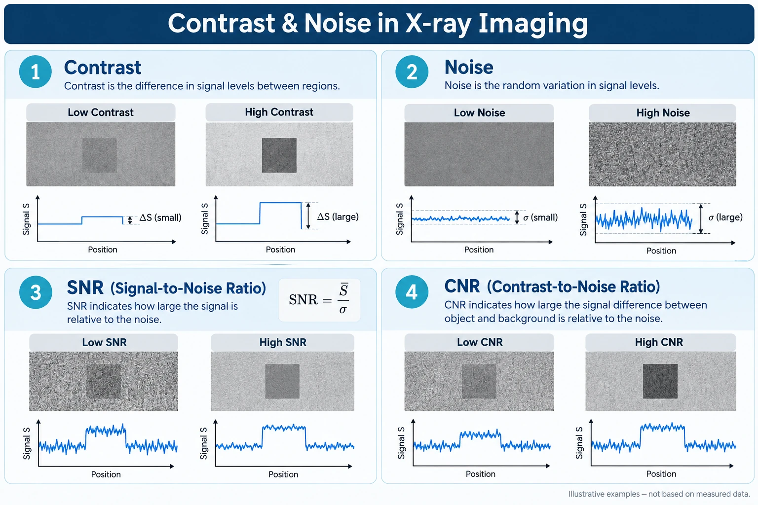 X-ray 영상에서 Contrast, Noise, SNR, CNR의 차이를 Low와 High 조건의 영상 예시와 신호 프로파일로 비교한 기술 도식