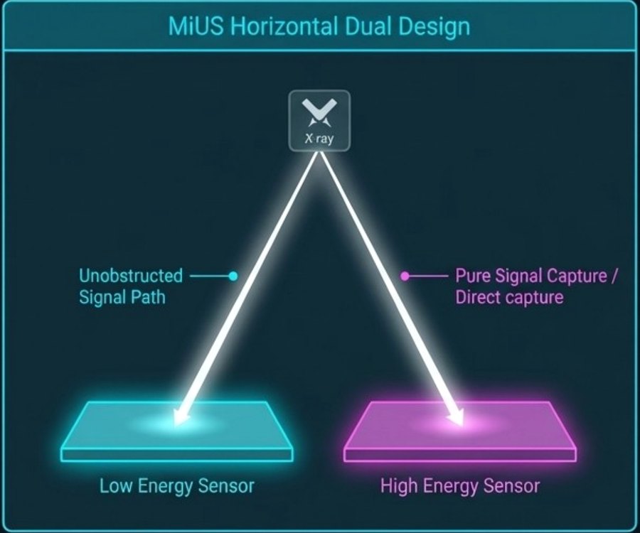 MiUS 수평형 Dual-Energy 구조 이미지